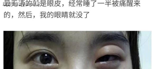 被蚊子咬过最无语的位置  被蚊子咬过最无语的位置